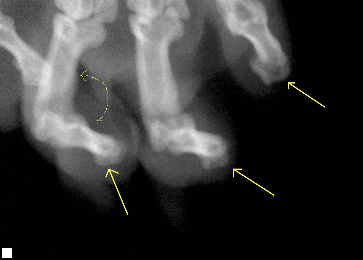 x-rays